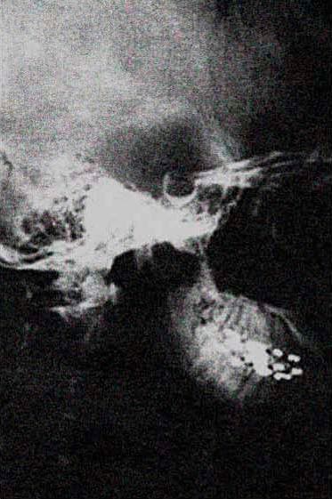 Ciegate Para Siempre